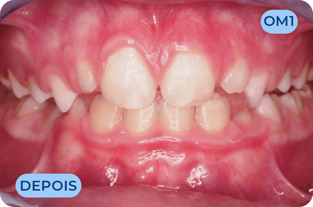 Odontologia Miofuncional